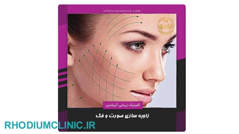 آپیلنس، مرکز کانتورینگ صورت در کرج