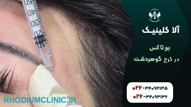 آلا بوتاکس گوهردشت