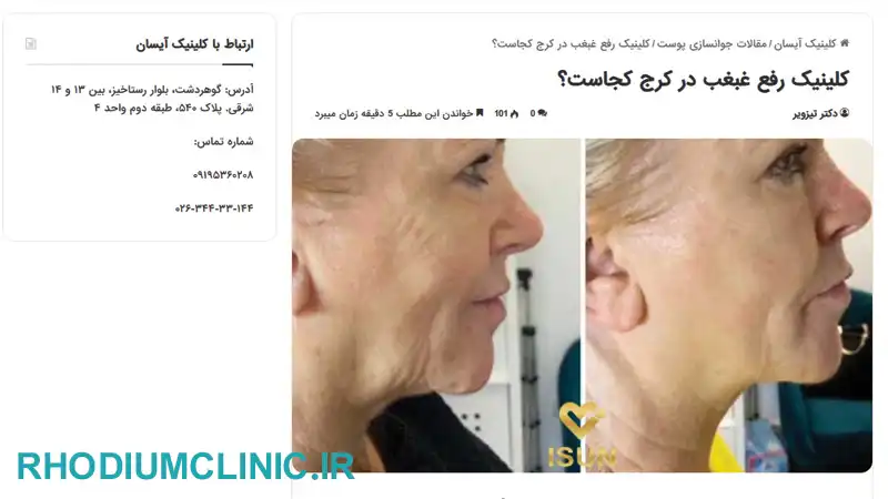 آیسان، کلینیک تخصصی رفع غبغب در کرج