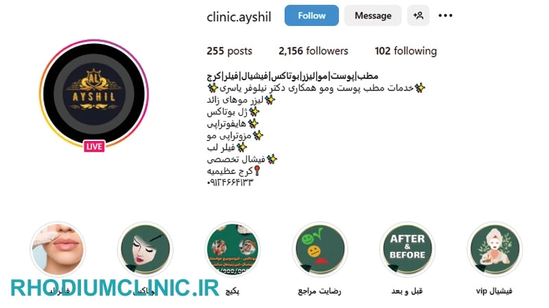 آیشیل لیزر موهای زائد عظیمیه