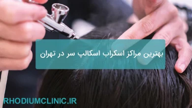 اسکراب اسکالپ سر