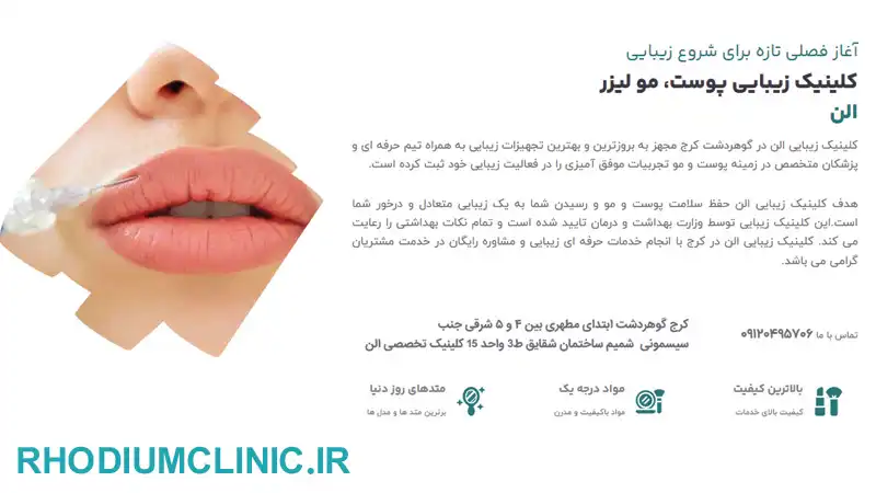 الن، بهترین مرکز لیزر مو در گوهردشت