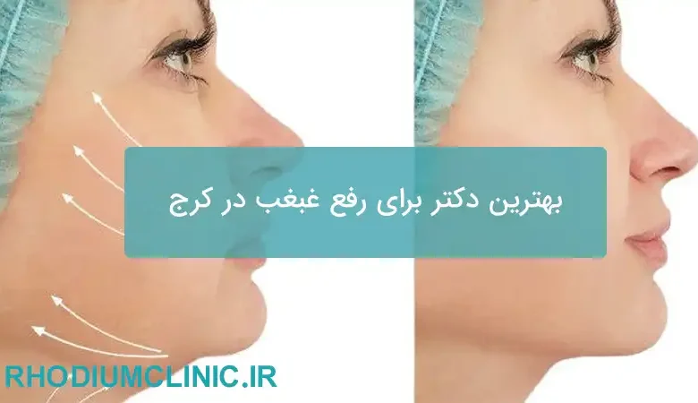 بهترین دکتر برای رفع غبغب در کرج