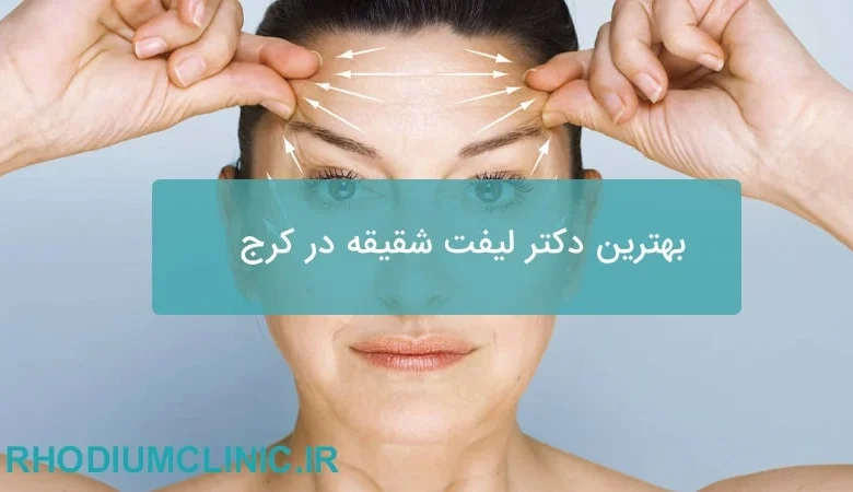 بهترین دکتر لیفت شقیقه در کرج