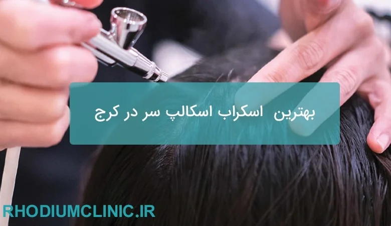  بهترین مرکز اسکراب اسکالپ سر در کرج
