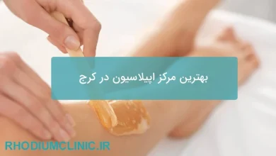 بهترین مرکز اپیلاسیون در کرج
