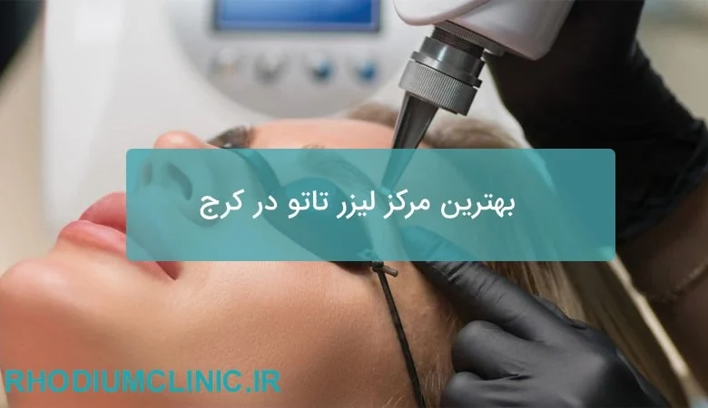 بهترین مرکز لیزر تاتو در کرج