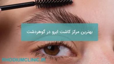 بهترین مرکز کاشت ابرو در گوهردشت