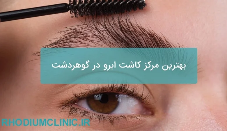 بهترین مرکز کاشت ابرو در گوهردشت