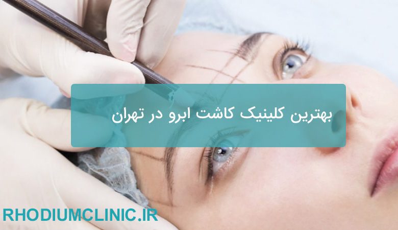 بهترین کلینیک کاشت ابرو در تهران