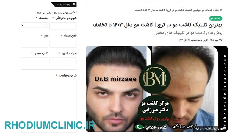 بهزاد میرزایی، دکتر کاشت ریش و سبیل در کرج