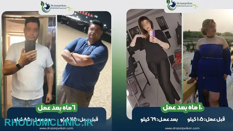 دکتر علیرضا آذرپیکان، بهترین جراح لاغری در تهران