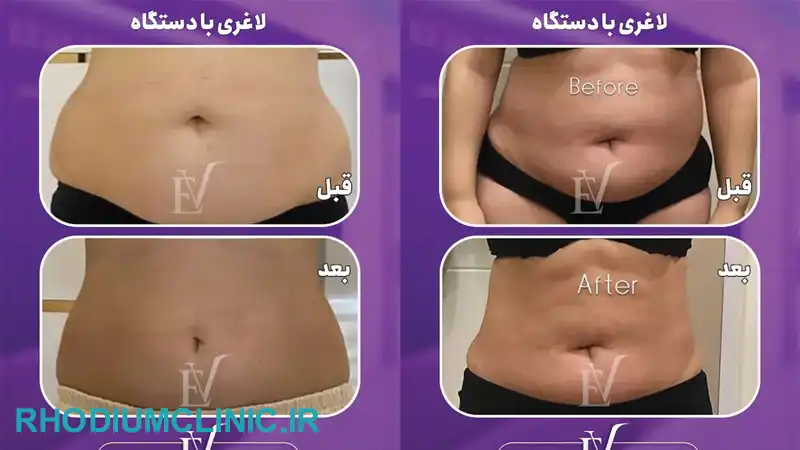 سارا بهروان، بهترین دکتر لاغری در تهران