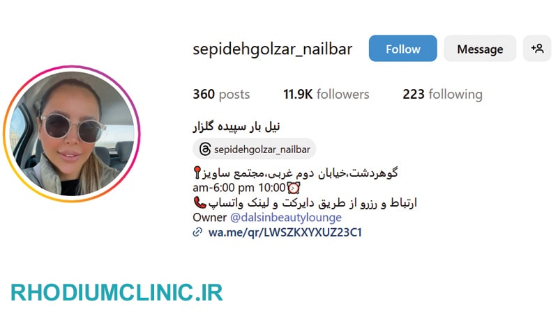 سپیده گلزار، ناخن کار خوب در گوهردشت