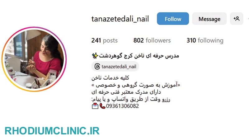 طناز اعتدالی، بهترین ناخن کار در گوهردشت