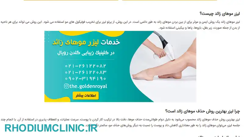 مرکز لیزر موهای زائد گلدن رویال در تهران