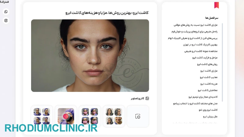 مرکز کاشت ابرو الهام در تهران