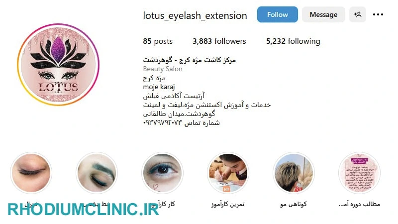 نسترن فدائی مژه کار گوهردشت