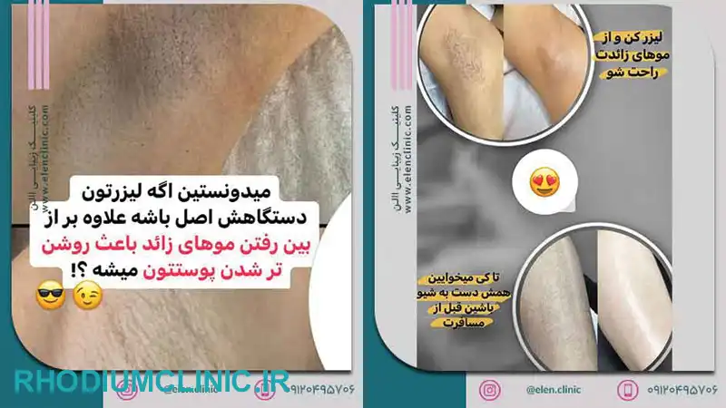 نمونه کار کلینیک آلن