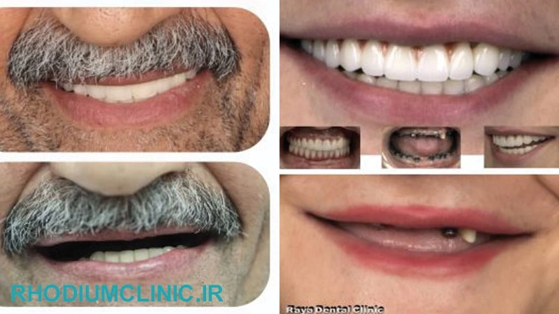 نمونه کار رایا