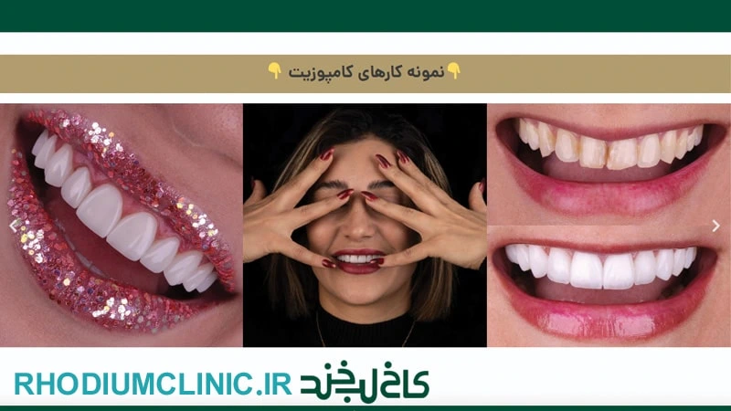 کاخ لبخند دکتر دندانپزشکی در تهران