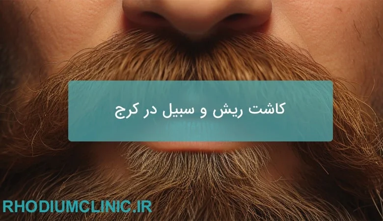 کاشت ریش و سبیل در کرج