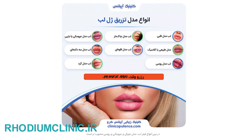 کلینیک تزریق فیلر آپیلنس در گوهردشت
