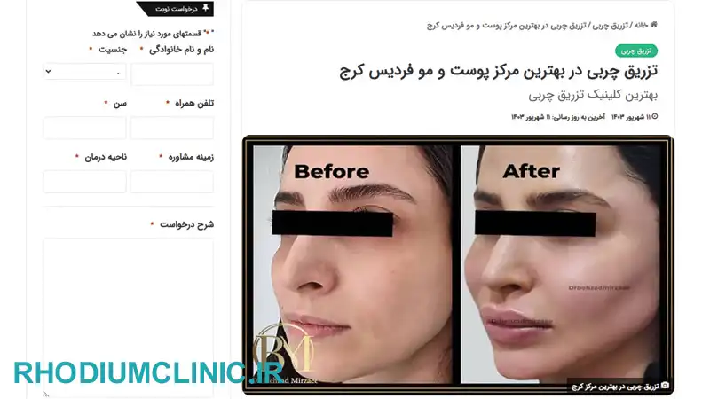 کلینیک تزریق چربی دکتر بهزاد میرزایی در کرج