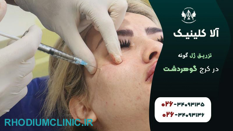 کلینیک تزریق ژل آلا در گوهردشت