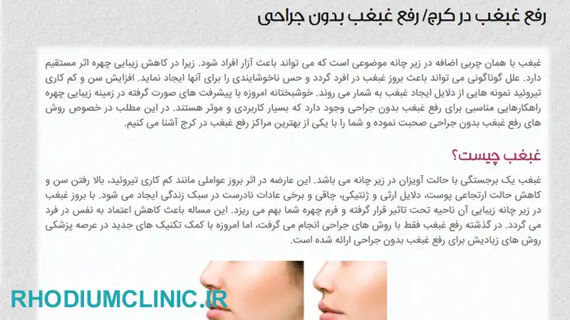 کلینیک رفع غبغب آنسه در کرج