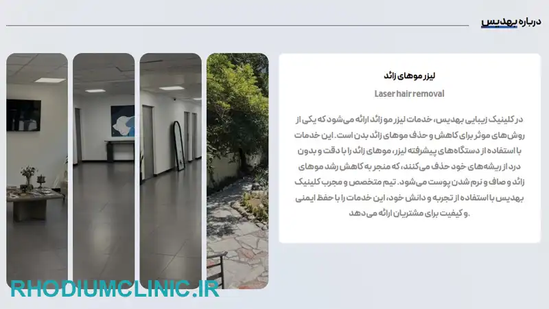 کلینیک لیزر موهای زائد بهدیس در تهران
