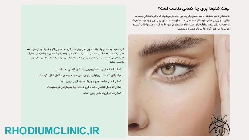 کلینیک لیفت شقیقه آراکام در کرج