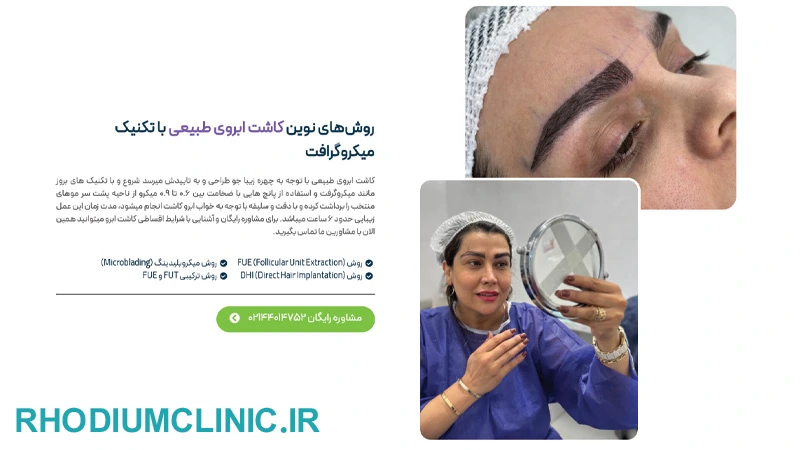 کلینیک کاشت ابرو پارمین در تهران