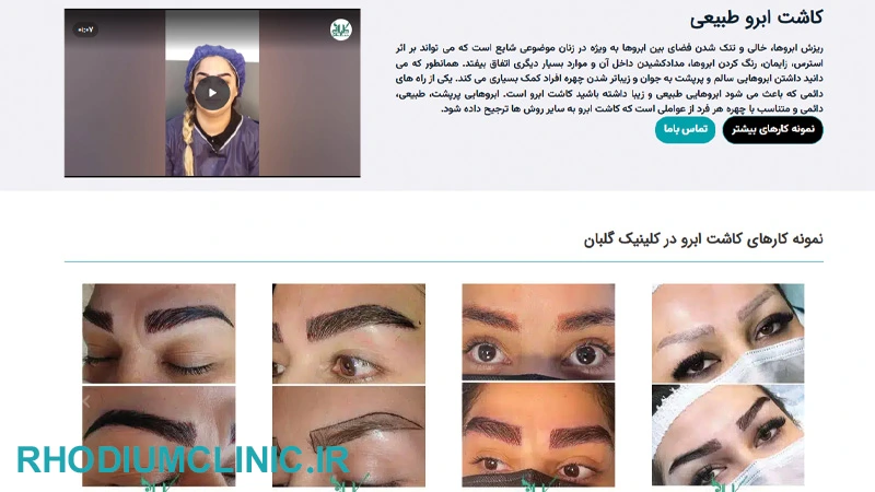 گلبان، بهترین کلینیک کاشت ابرو در تهران