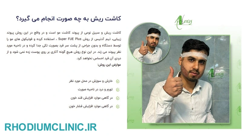 آدِنیس، بهترین دکتر کاشت ریش در تهران