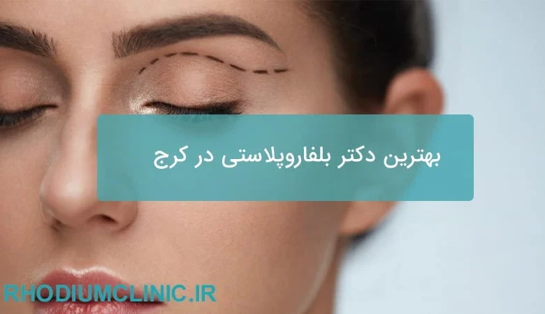 بهترین دکتر بلفاروپلاستی در کرج