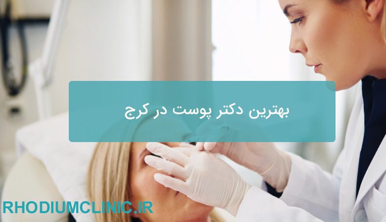 بهترین دکتر پوست در کرج