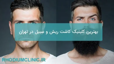 بهترین کلینیک کاشت ریش و سبیل در تهران 