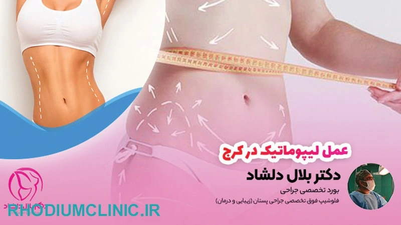 دکتر بلال دلشاد، مرکز لیپوماتیک در کرج
