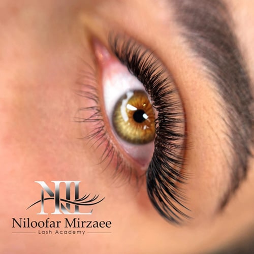 نمونه کاشت مژه نیلوفر میرزایی