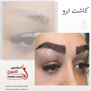 نمونه کار کلینیک تندیس 2
