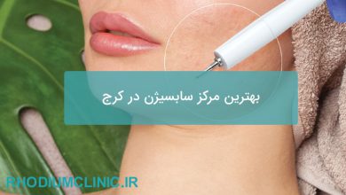 بهترین مرکز سابسیژن در کرج