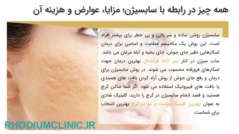 شادی مظلومی، بهترین دکتر سابسیژن در کرج