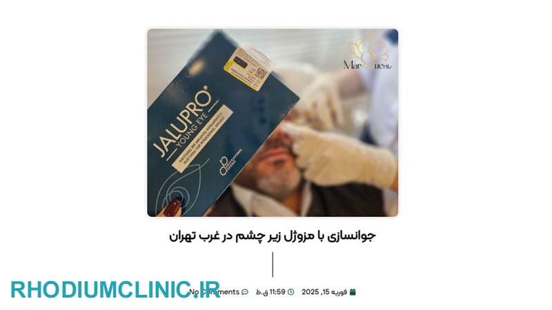 کلینیک تزریق مزوژل مارگریت در تهران