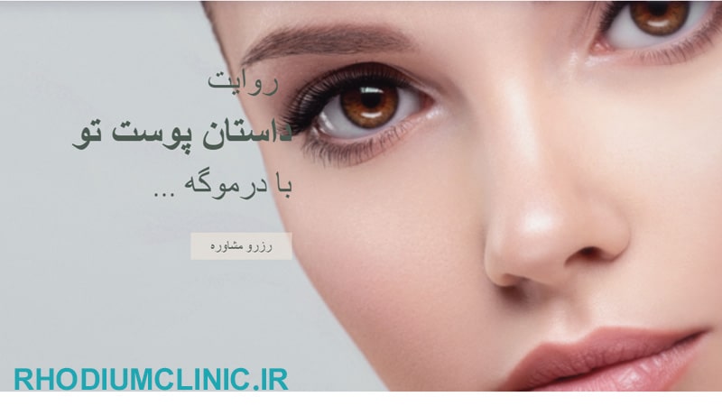 کلینیک زیبایی درموگه در خیابان فرشته