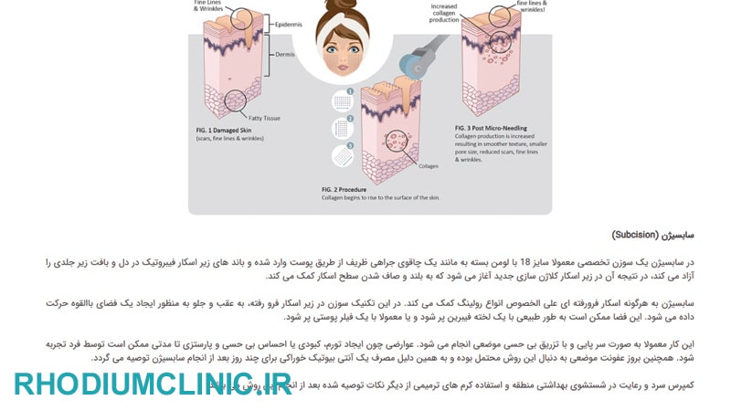 کلینیک سابسیژن مهر در کرج