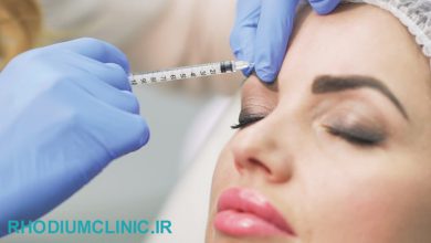 بهترین دکتر بوتاکس در زعفرانیه