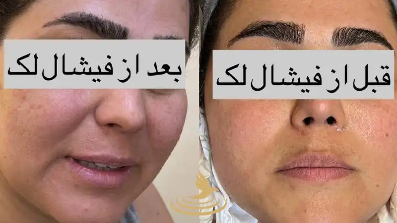 فیشیال فاخته 1