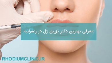 معرفی بهترین دکتر تزریق فیلر و ژل در زعفرانیه