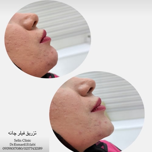 نمونه خدمات دکتر اطلابی